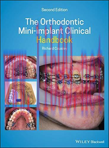 [AME]The Orthodontic Mini-implant Clinical Handbook, 2nd Edition