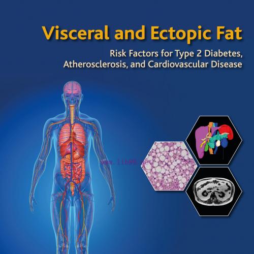 [AME]Visceral and Ectopic Fat: Risk Factors for Type 2 Diabetes, Atherosclerosis, and Cardiovas...