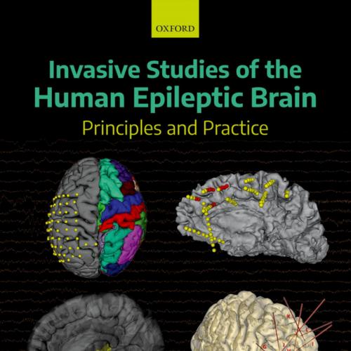 Invasive Studies of the Human Epileptic Brain Principles and Practice