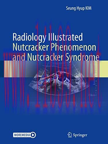 [AME]Radiology Illustrated: Nutcracker Phenomenon and Nutcracker Syndrome (Original PDF)