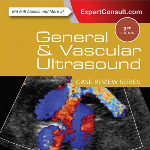 General and Vascular Ultrasound_ Case Review Series-John McGahan & Sharlene A. Teefey & Laurenc...
