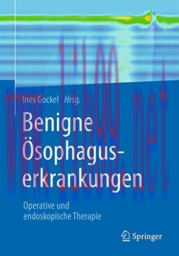 [AME]Benigne &Ouml;sophaguserkrankungen: Operative und endoskopische Therapie (German Edition) (Orig...