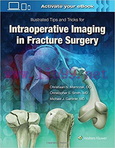 [EPUB]Illustrated Tips and Tricks for Intraoperative Imaging in Fracture Surgery