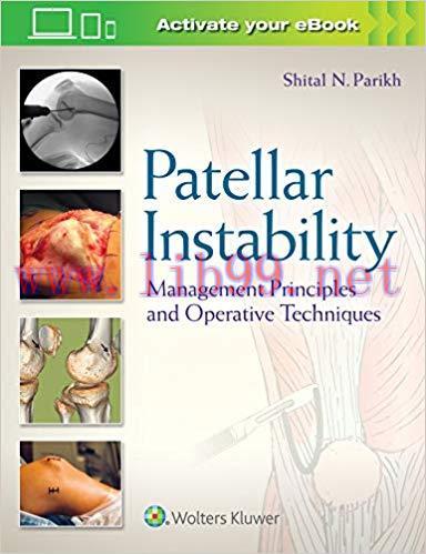 [EPUB]Patellar Instability Management Principles and Operative Techniques
