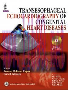 [AME]Transesophageal Echocardiography of Congenital Heart Diseases