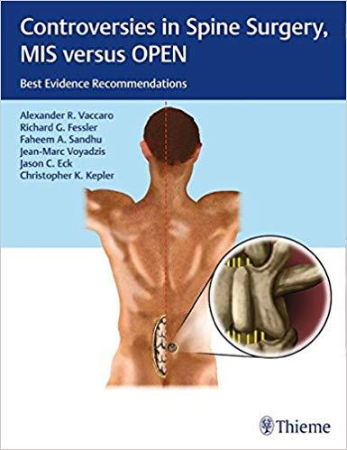 Controversies in Spine Surgery, MIS versus OPEN