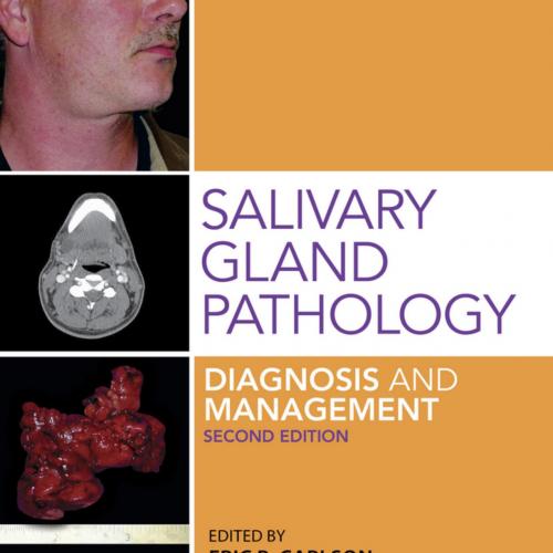 Salivary Gland Pathology Diagnosis and Management, 2nd Edition