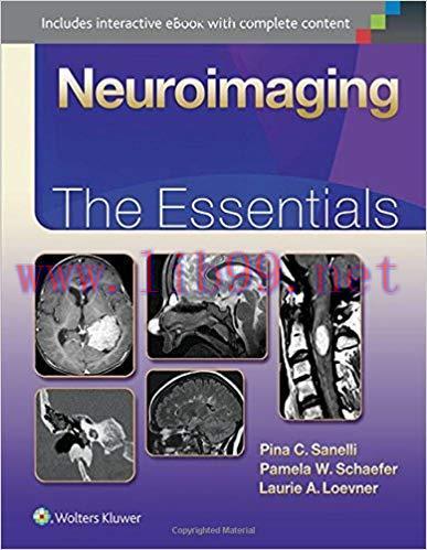 [CHM]Neuroimaging - The Essentials
