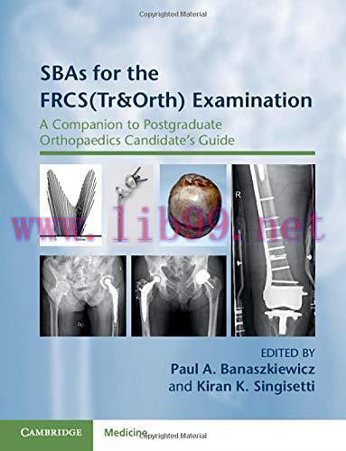 [AME]SBAs for the FRCS(Tr&Orth) Examination (A Companion to Postgraduate Orthopaedics Candidate...