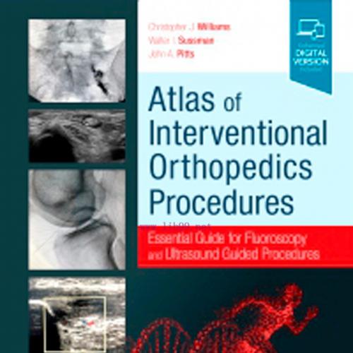 [AME]Atlas of Interventional Orthopedics Procedures: Essential Guide for Fluoroscopy and Ultras...
