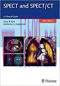 [AME]SPECT and SPECT/CT: A Clinical Guide (EPUB)