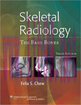 [AME]Skeletal Radiology: The Bare Bones, 3rd Edition
