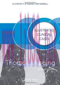 [AME]Thoracic Imaging: Illustrated Clinical Cases, Second Edition