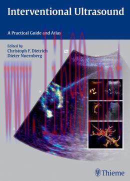 [AME]Interventional Ultrasound: A Practical Guide and Atlas (ORIGINAL PDF from_ Publisher)