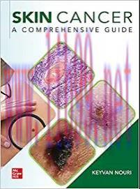 [AME]Skin Cancer: A Comprehensive Guide (EPUB)