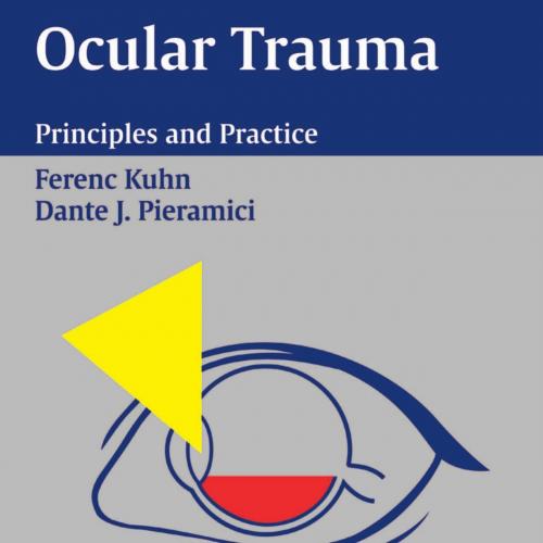 Ocular Trauma Principles and Practice