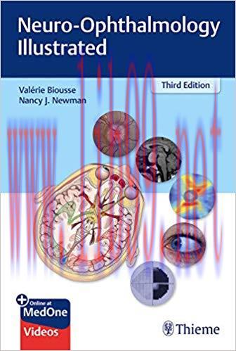 [PDF]Neuro-Ophthalmology Illustrated 3rd Edition PDF+69 VIDEOS