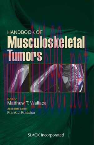 [PDF]Handbook of Musculoskeletal Tumors