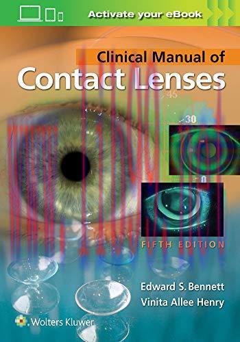 [AME]Clinical Manual of Contact Lenses, 5th Edition (EPUB)