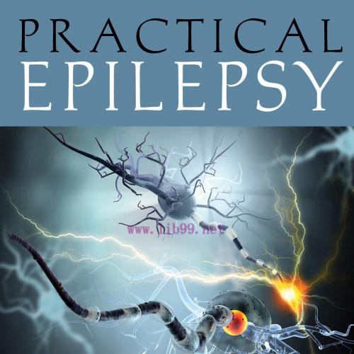 [AME]Practical Epilepsy (PDF)