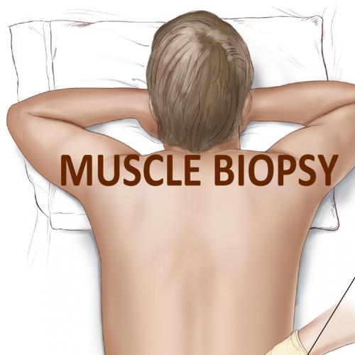 Muscle Biopsy ed. by Challa Sundaram