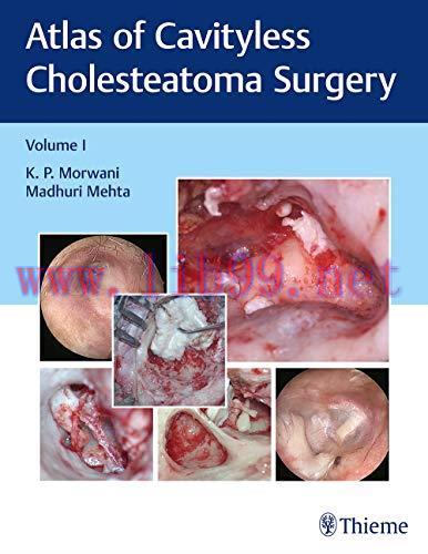 [AME]Atlas of Cavityless Cholesteatoma Surgery (Volume 1) (Original PDF)