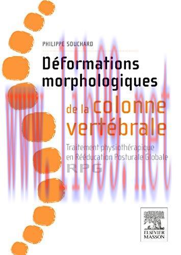 [AME]D&eacute;formations Morphologiques De La Colonne Vert&eacute;brale: Traitement Physioth&eacute;rapique En R&eacute;&eacute;du...
