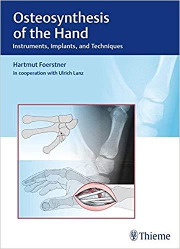 Osteosynthesis of the Hand - Instruments, Implants, and Techniques