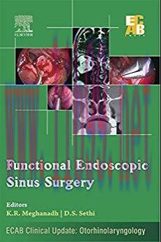[PDF]Functional Endoscopic Sinus Surgery