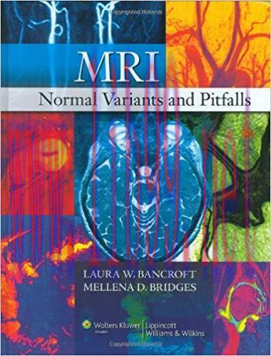 [CHM]MRI Normal Variants and Pitfalls, 1st Edition