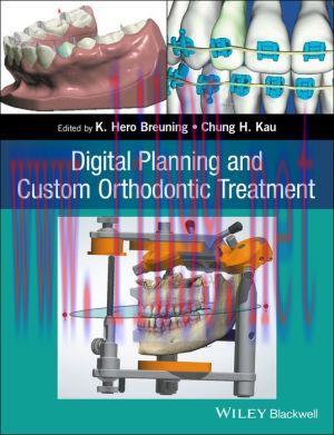 [AME]Digital Planning and Custom Orthodontic Treatment (EPUB)