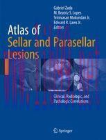 [PDF]Atlas of Sellar and Parasellar Lesions: Clinical, Radiologic, and Pathologic Correlations