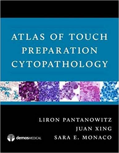 Atlas of Touch Preparation Cytopathology 1st Edition