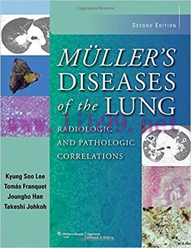 [PDF]Muller’s Diseases of the Lung Radiologic and Pathologic Correlations, 2nd Edition