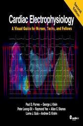 [AME]Cardiac Electrophysiology: A Visual Guide for Nurses, Techs, and Fellows, Second Edition (...