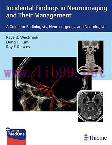 [AME]Incidental Findings in Neuroimaging and Their Management: A Guide for Radiologists, Neuros...