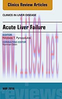 [AME]Acute Liver Failure, An Issue of Clinics in Liver Disease (Volume 22-2) (The Clinics: Inte...