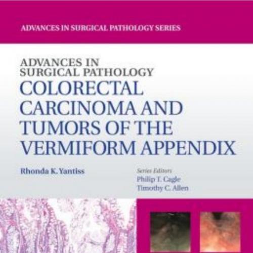 Advances in Surgical Pathology _ Colorectal Carcinoma and Tumors of the Vermiform Appendix - Ya...