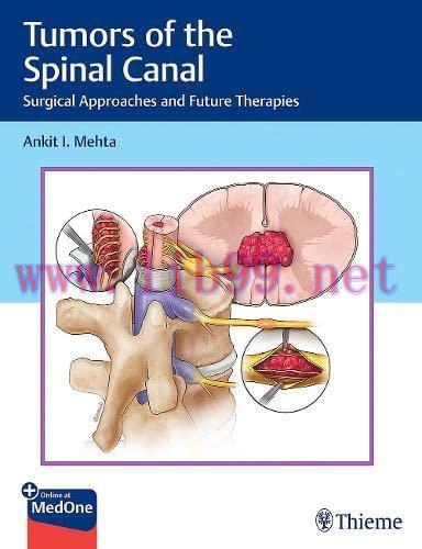 [AME]Tumors of the Spinal Canal: Surgical Approaches and Future Therapies (Original PDF)