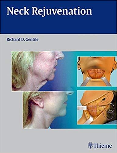 Neck Rejuvenation [Richard D. Gentile]