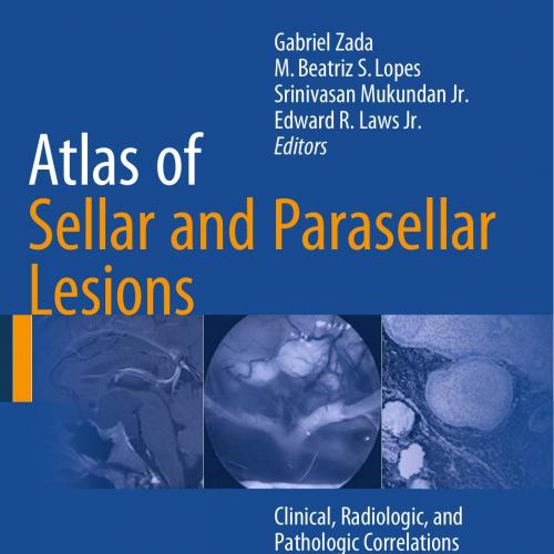 Atlas of Sellar and Parasellar Lesions Clinical, Radiologic, and Pathologic Correlations - Wei ...