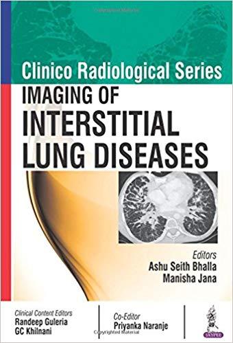 Imaging of Interstitial Lung Diseases