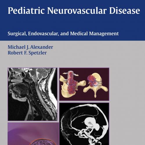 Pediatric Neurovascular Disease Surgical,Endovascular and