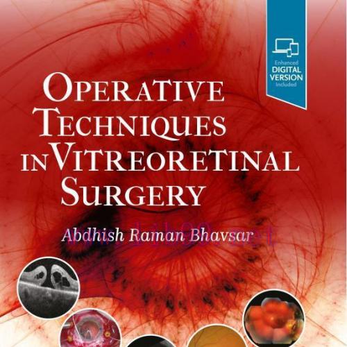[AME]Operative Techniques in Vitreoretinal Surgery (EPUB)
