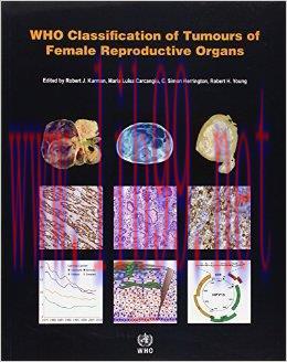 [AME]WHO Classification of Tumours of the Female Reproductive Organs (IARC WHO Classification o...