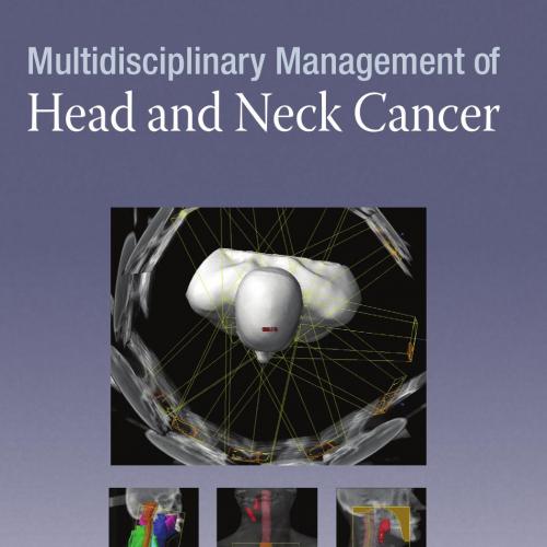 Multidisciplinary Management of Head and Neck Cancer