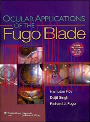 [PDF]Ocular Applications of the Fugo Blade
