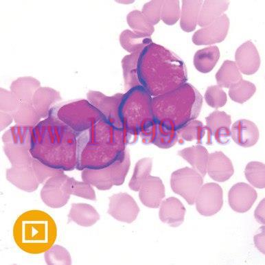 [AME]Current Concepts in Hematopathology 2022 (CME VIDEOS)