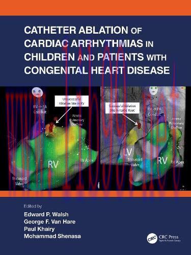 [AME]Catheter Ablation of Cardiac Arrhythmias in Children and Patients with Congenital Heart Di...