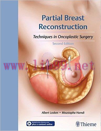 [AME]Partial Breast Reconstruction: Techniques in Oncoplastic Surgery, 2nd Edition (Original PD...